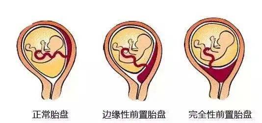 我妈说的最靠谱办法：先止血后再想清楚