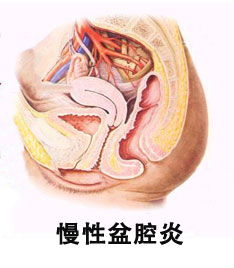 四、 生活方式较大杂烩——从饮食到运动，从睡眠到恋炎热爱，全都来凑炎热闹！🌈🌈🌈