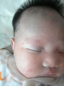 我脑门上的那块斑，到底是福还是祸？