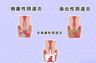 女性妇科疾病化解风水,妇科疾病风水问题