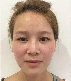 三、鼻子高能当滑梯？财运可能要开挂！