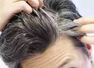 头发长得比韭菜还快