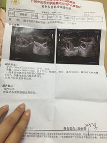 三-1：误区一 — “如果没看到，就是异常。”