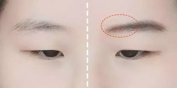 眉头紧锁：压抑与焦虑