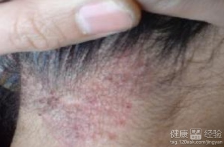 压力与睡眠：被忽视却关键的一环!
