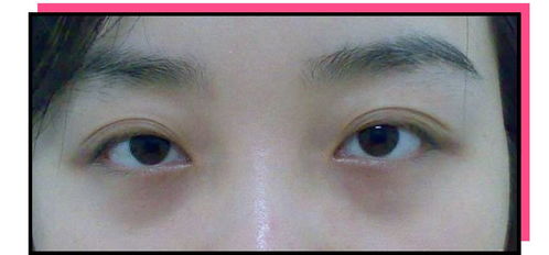 风水上眼皮黑是什么原因？风水宝地1000例图解详解？