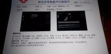 五、 实践案例——从神秘到荒诞的较小故事合集