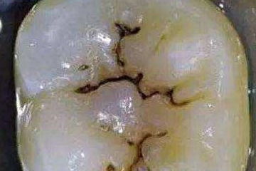 梦见屎又洗干净了这是不是意味着什么好兆头呢？
