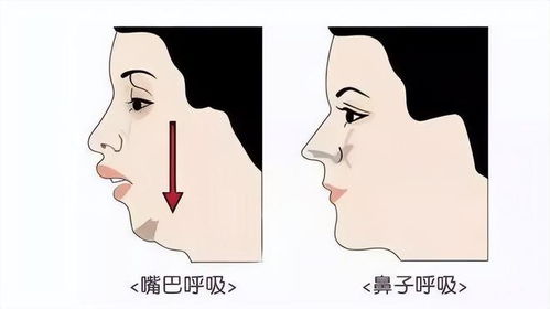 第一种：让人摸不着头脑的怪性鼻
