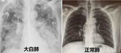 白色与医疗疾病：梦境中的隐秘联系
