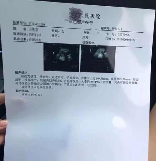 1、 先说说这件事到底是啥玩意儿