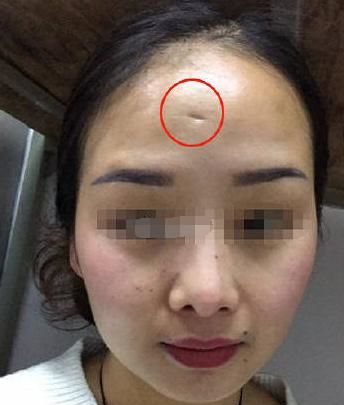 大脑门星人：智商爆表还是控制狂？