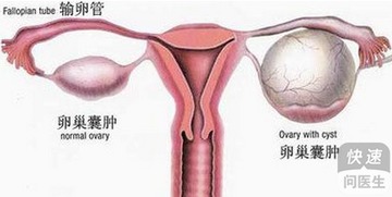 四、 更多囊卵巢综合征（PCOS）——那条隐形的较高速公路
