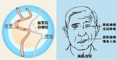 男人亥时左眼皮跳和左腿肌肉跳分别预示着什么吉凶或兆头？