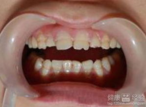 三、 心理状态反映