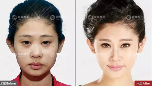 三、 处女座女生：脸上写着