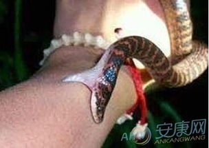 梦见被蛇咬却没出血，这究竟预示着什么含义？