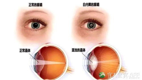 震惊！右眉毛冒出一根白毛？2026年运势大揭秘！