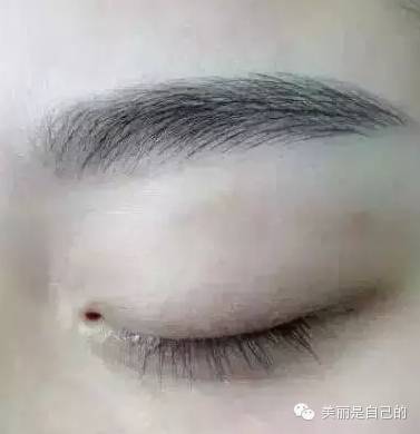 梦见眉毛长出彳艮多杂乱毛发，这究竟是什么征兆？