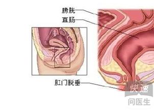 最主要临床表现