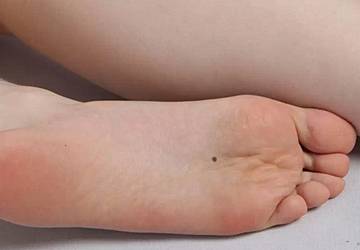 踩狗屎运还是踩金元宝？