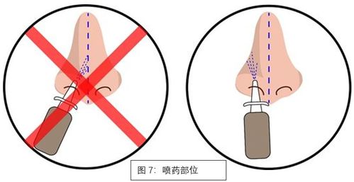 鼻子左侧跳动吉凶，右侧跳动预示什么？