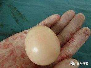 浙江新生女婴出生时为何会带着一块玉石？