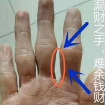 如何改善手脚指关节处硬皮的问题？