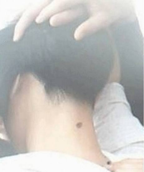 惯与苦情痣的一些乱七八糟的说法