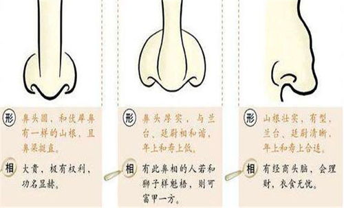 天庭有痔：等等不对是天庭有痔...痔？是痔不是痔...