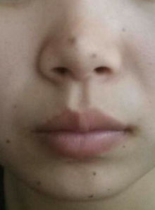 啊啊啊！嘴唇上面的痣是桃花劫预警！