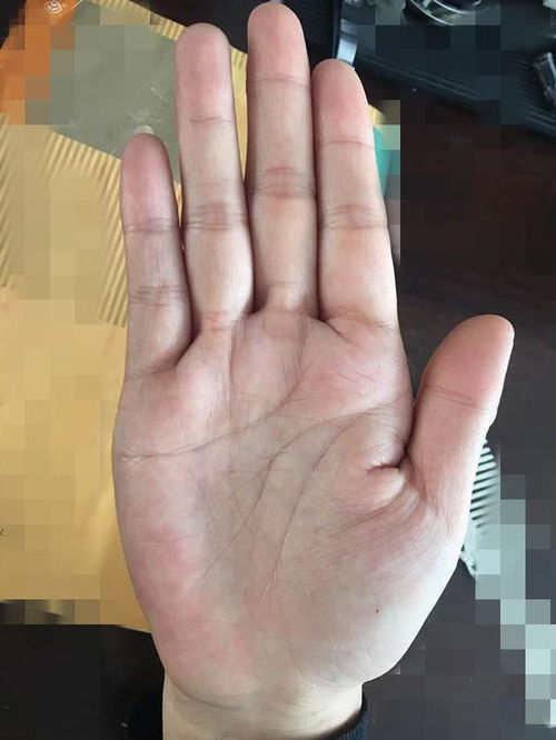 脚底下长瘊子风水,脚底下长痦子是什么意思